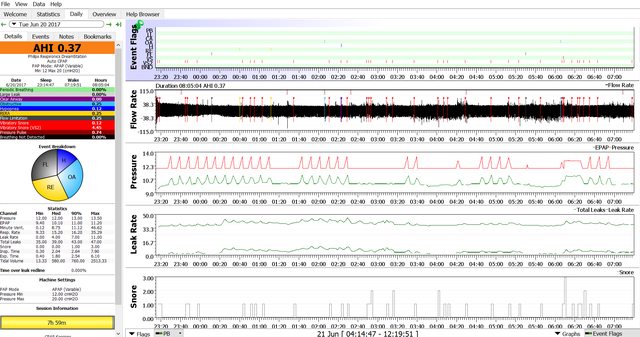 FAQ - Philips Respironics DreamMapper